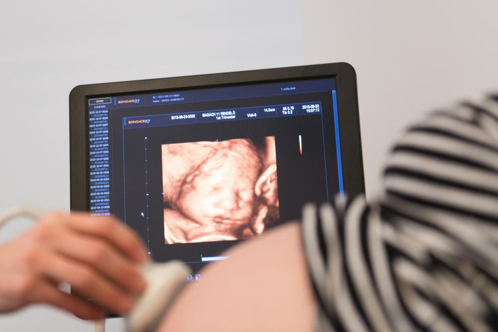 ✨ KORATERHES TANÁCSADÁS ✨